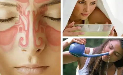 Cele mai bune moduri de a curăța sinusurile natural