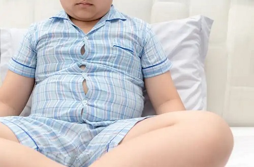 Copil afectat de obezitate