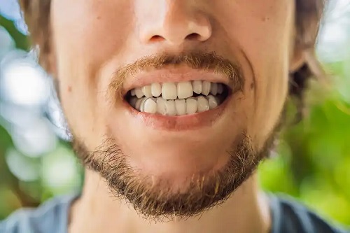Bărbat cu dinți strâmbi