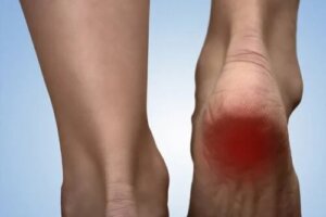 6 exerciții pentru a trata pintenii calcaneeni