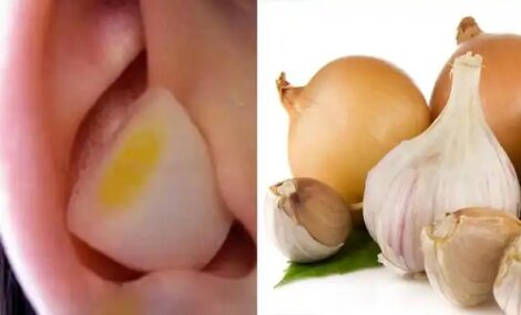 De ce este benefic să pui usturoi sau ceapă în ureche?