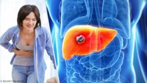 Tot ce trebuie să știți despre angiomul hepatic și tratamentul lui