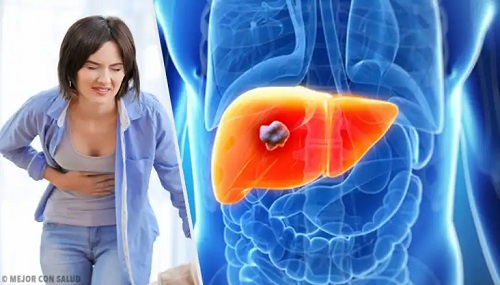 Tot ce trebuie să știți despre angiomul hepatic și tratamentul lui