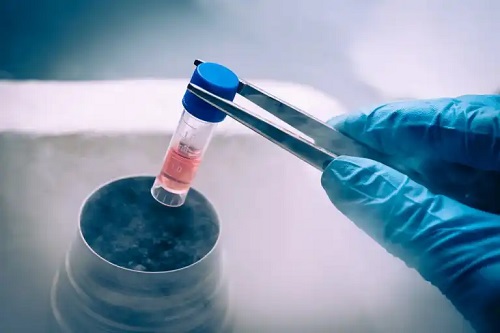 Conservarea celulelor stem: în ce constă?