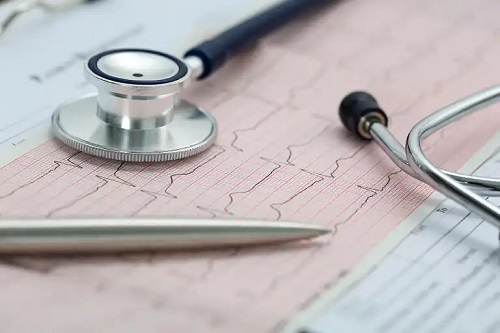 Ekg analizat de medic