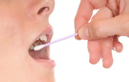 Rolul salivei în sănătatea orală