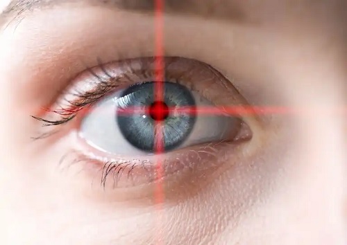 Tipuri de chirurgie refractivă