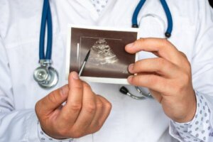 Ce este feocromocitomul și care sunt simptomele acestuia?