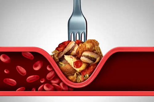 9 strategii pentru scăderea colesterolului