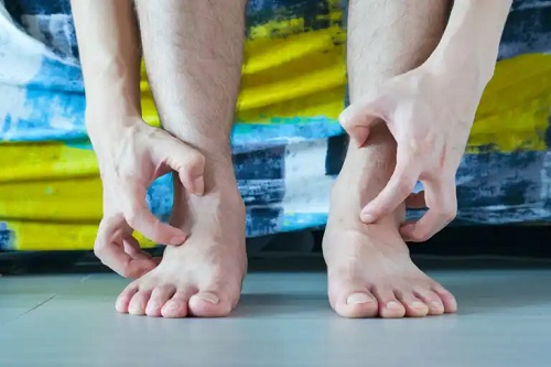10 cauze ale mâncărimii picioarelor și ce trebuie făcut