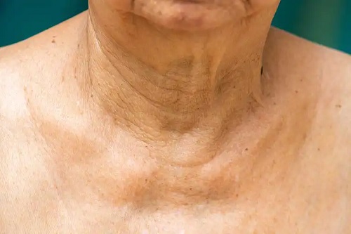 Îngrijirea pielii gâtului în funcție de vârstă