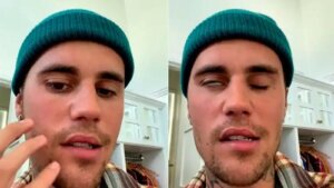 Justin Bieber are sindromul Ramsay Hunt și își suspendă turneul