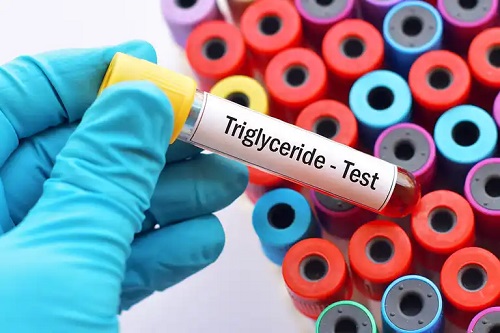Medic ce analizează cauzele trigliceridelor mari