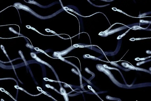 Necrozoospermia: cauza morții spermatozoizilor