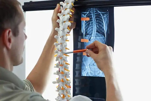 Medic care analizează atitudinea scoliotică