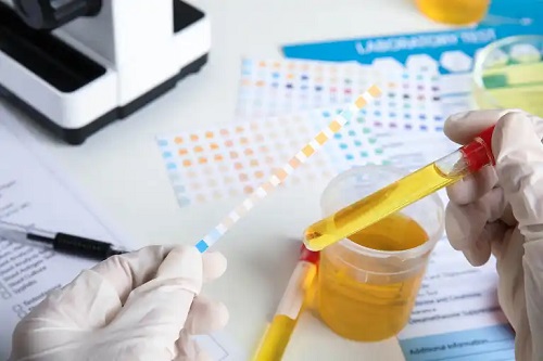Medic care analizează bacteriile din urină