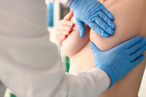 Medic ce analizează sfârcurile umflate