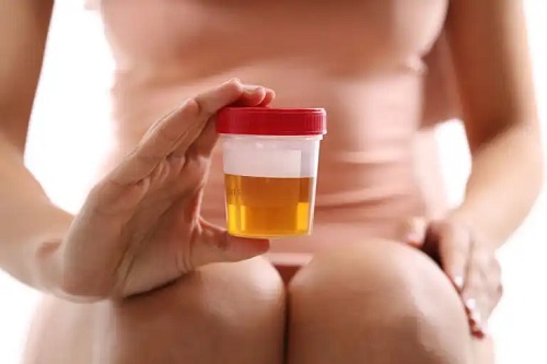 Persoană care a colectat o probă de urină