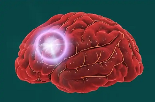 Probleme cerebrale la nivelul lobului central