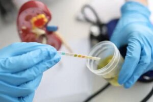 Urobilinogenul în urină: cauze și valori normale