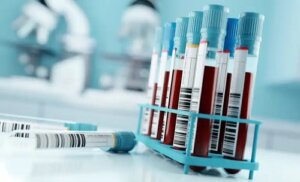 Analiza proteinelor totale: rezultate și semnificația lor