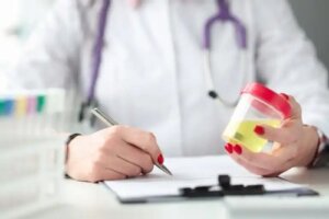 Analiza ureei și creatininei în urină: ce înseamnă rezultatele