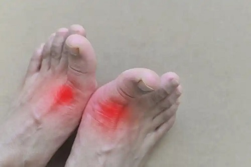 Cauze ale durerii la degetele de la picioare