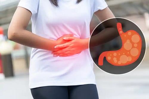 Femeie care suferă de reflux acid