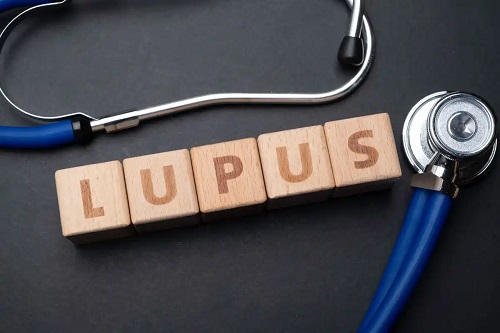 Lupusul pe lista de tulburări ale globulelor albe