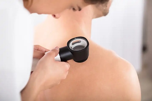 Medic care folosește terapia fotodinamică