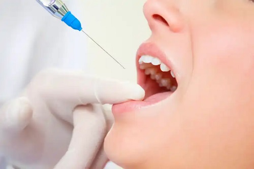 Plasma bogată în factori de creștere: utilizări în sănătatea orală