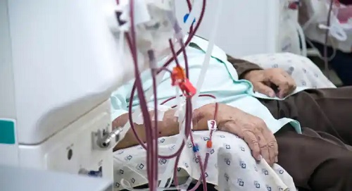 Ce este afereza terapeutică?