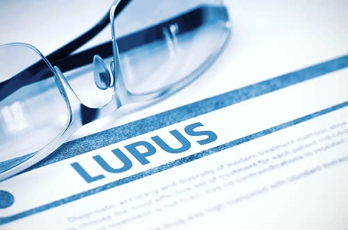 Totul despre lupus