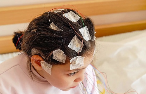 Electroencefalograma la copii