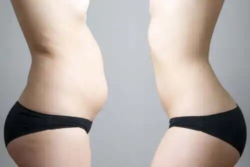 Persoană cu grăsime abdominală