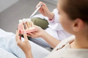 Ce sunt pivoții pentru implanturile dentare?