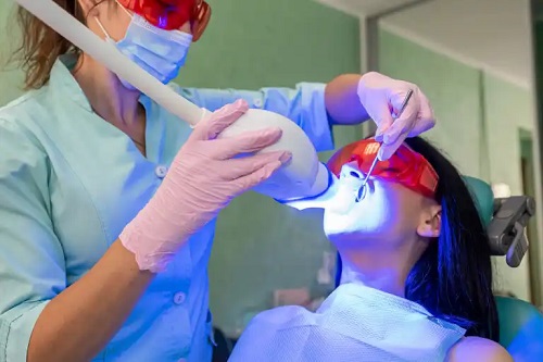 Albirea dinților cu LED: avantaje, dezavantaje și îngrijire