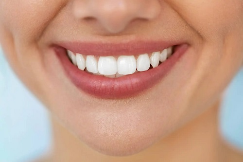 Dinți albi