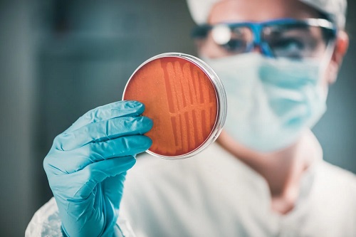 Medic care analizează o cultură bacteriană