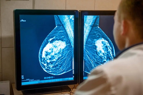 Medic care citește o mamografie