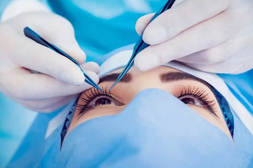 Medic care tratează pliul macular