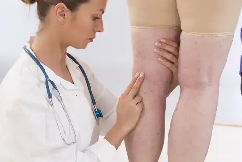 Medic care analizează simptome importante la femei