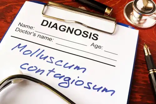 Diagnostic de molluscum contagiosum