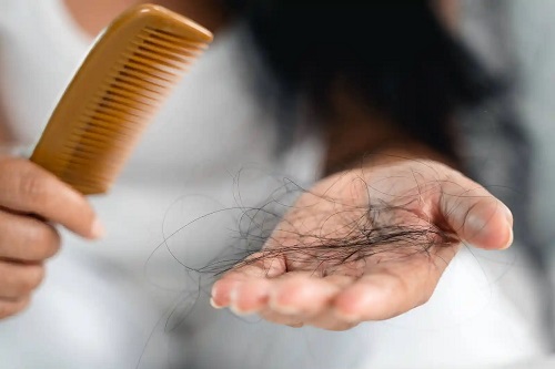 Păr care cade masiv