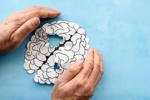 Rezerva cognitivă poate proteja împotriva leziunilor cerebrale