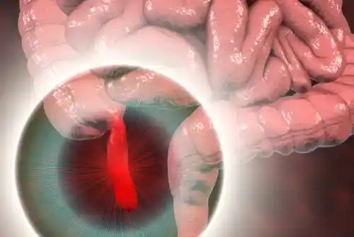 Rolul apendicelui în corpul uman