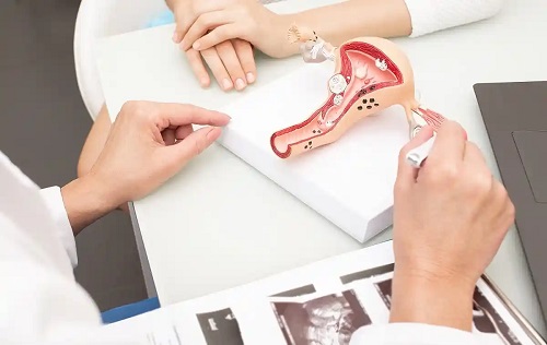 Specialist care vorbește despre uterul septat