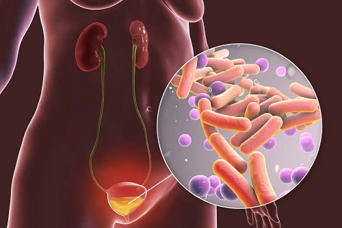 Bacterii în vezica urinară