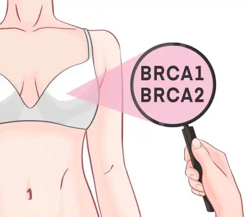 Rolul genelor BRCA-1 și BRCA-2 în cancerul de sân