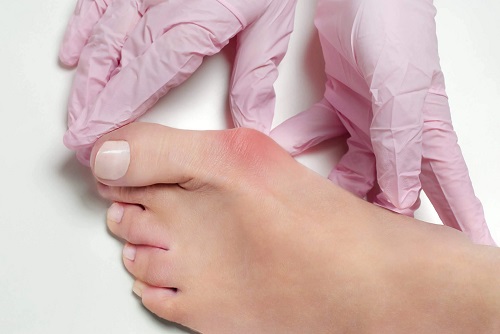 Medic care tratează durerea la degetul mare de la picior